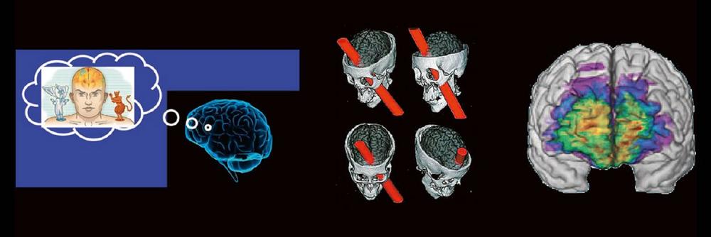 Outside the box-Vortrag: die Neuroradiologie der Moral (Webinar | Online)